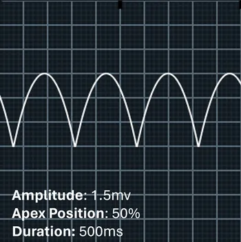 Image of the Amplidue at -2mv