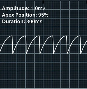 Image of the apex at 95% with positive amplitude