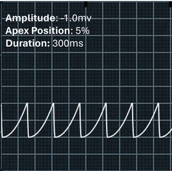 Image of the apex at 5% with negative amplitude