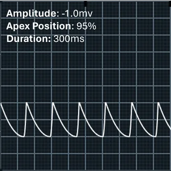 Image of the apex at 95% with negative amplitude