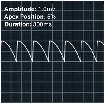 Image of the apex at 5% with positive amplitude