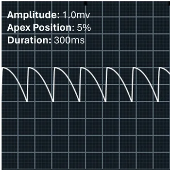 Image of the apex at 5% with positive amplitude