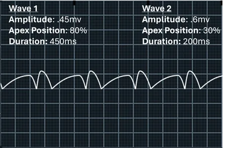 Image of multiple waves chained together