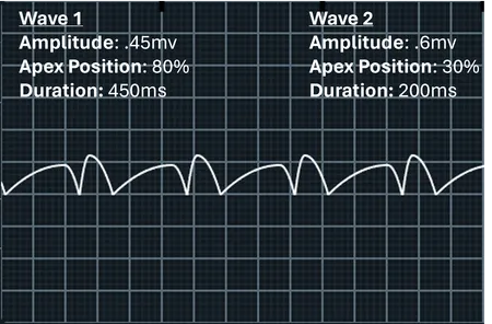 Image of multiple waves chained together